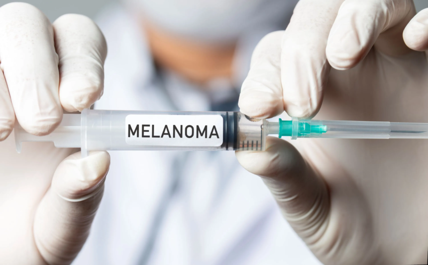 Vacuna melanoma